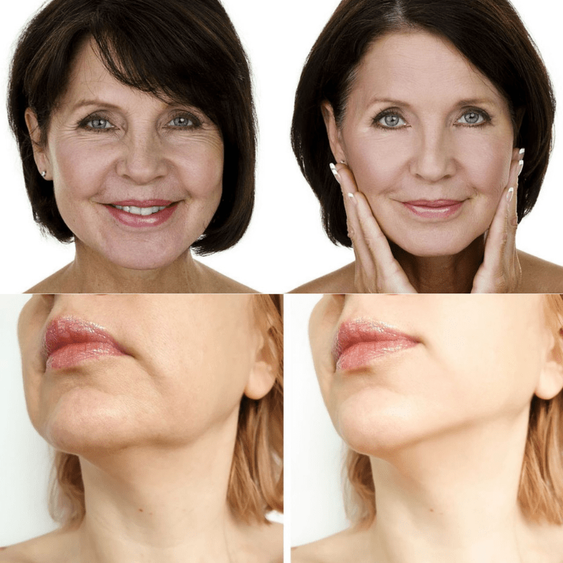 Face Glow 2.0® - Definição e Rejuvenescimento + Brinde